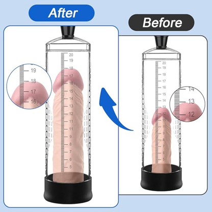 Penis Pump | Enlargement Therapy