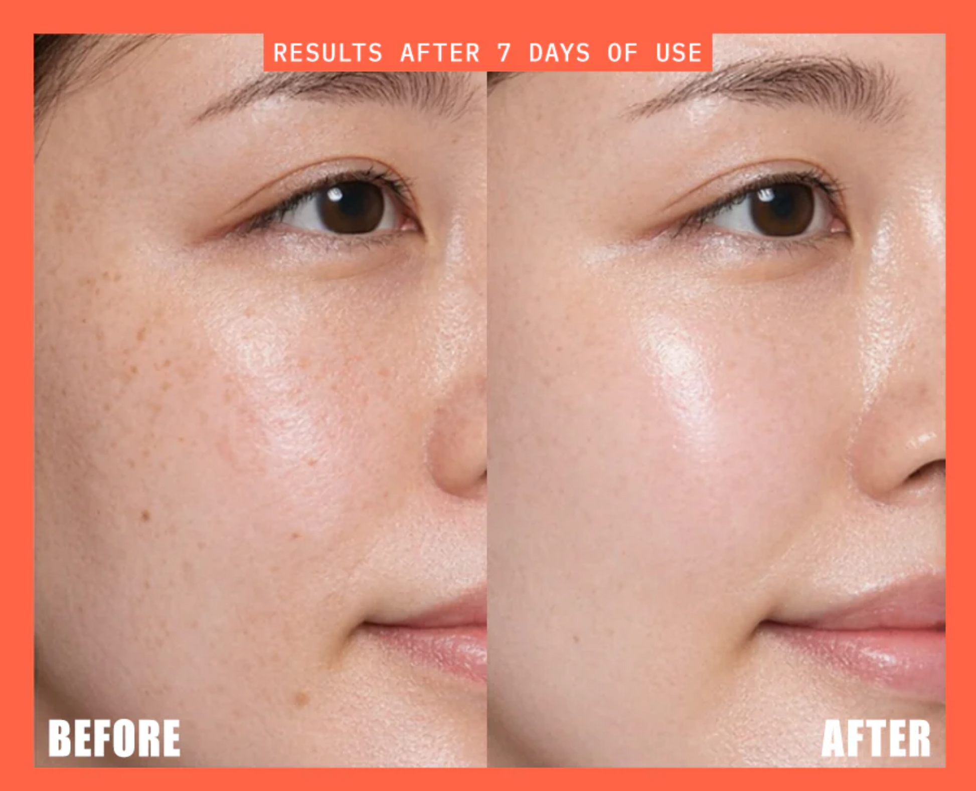 Glutathione Mero Deal